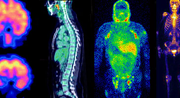 Medical Isotopes